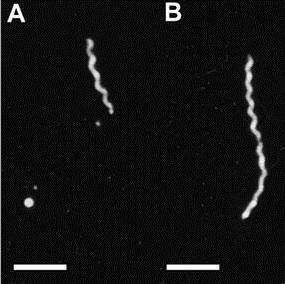 Treponema denticola figura 1 A e B (barra = 5 µm) microscopia de campo