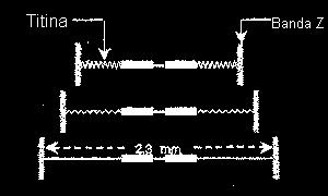 Estrutura microscópica do músculo esquelético Estrutura microscópica do músculo esquelético SARCÔMERO Considerada a menor unidade