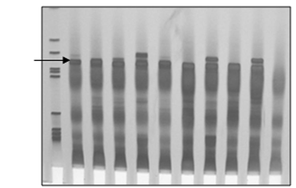 2416 Missawa NA et al. Figure 1 PAGE of PCR-amplified DNA of Lu.