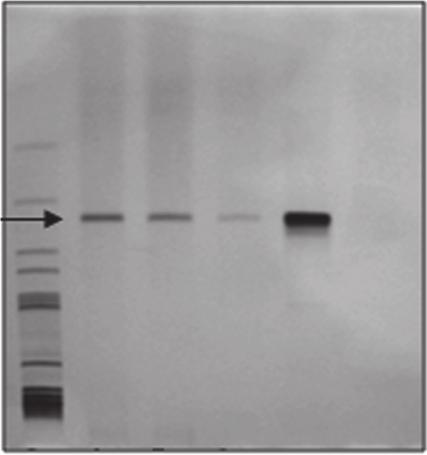 Figure 2 PAGE of PCR-amplified DNA of Leishmania-infected Lu.