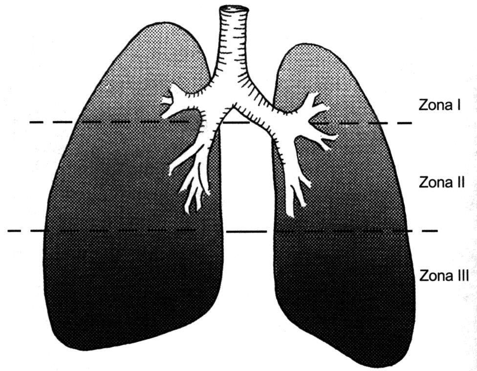 A perfusão pulmonar é dependente da postura.