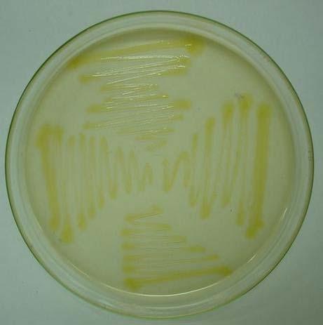 ananatis: O processo de isolamento de bactérias a partir de lesões anasarcas (Figura 1) foi bem sucedido, permitindo a obtenção de 20 isolados bacterianos a partir de 52 lesões.