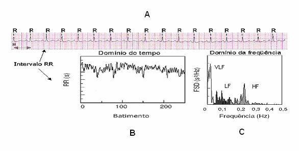 C) resultado da análise espectral, com identificação das três faixas de frequência. Fonte: www.cardios.com.br/jornais/jornal-20/metodos%20diagnosticos.