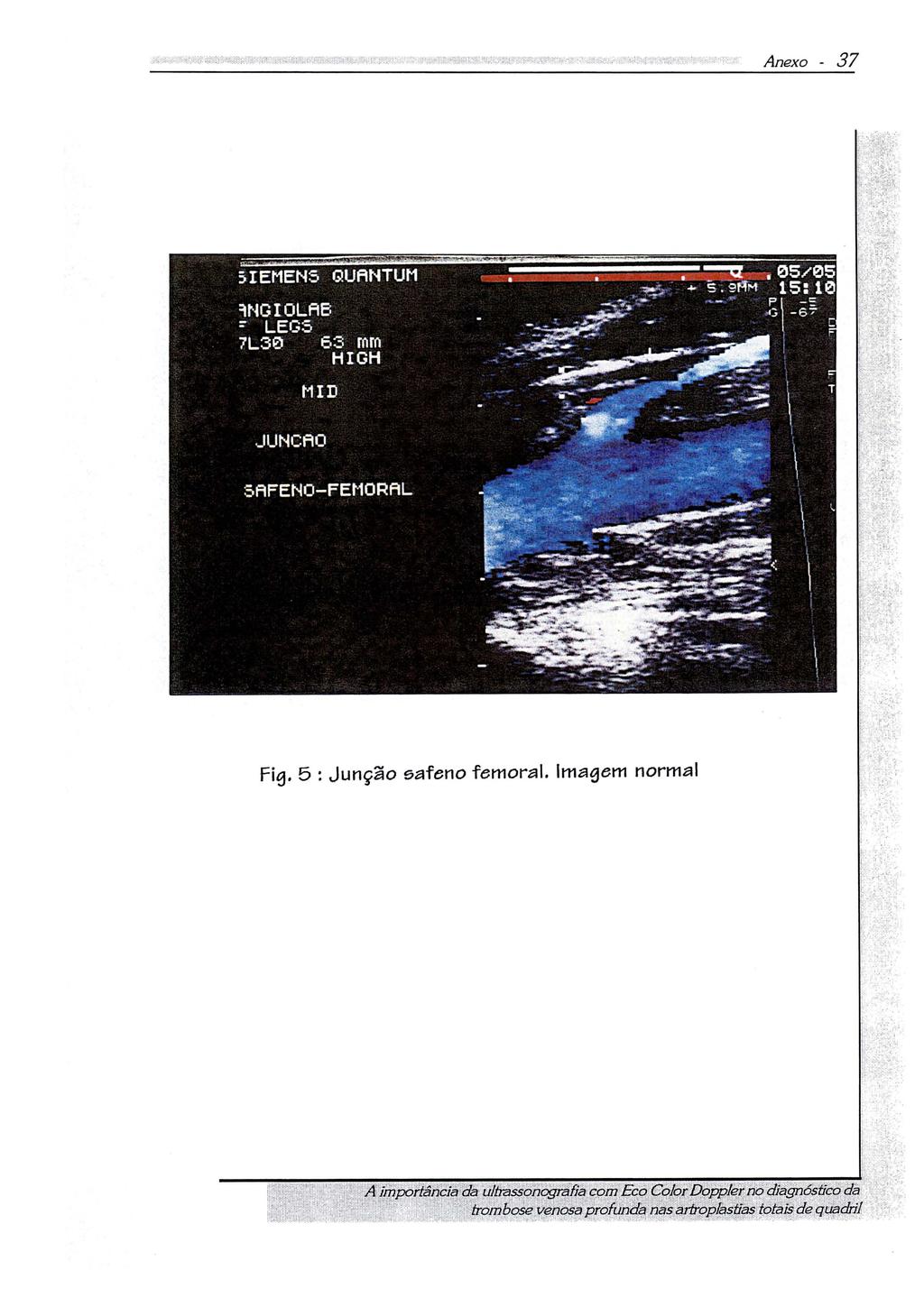 Fig. 5 : Junção eafeno