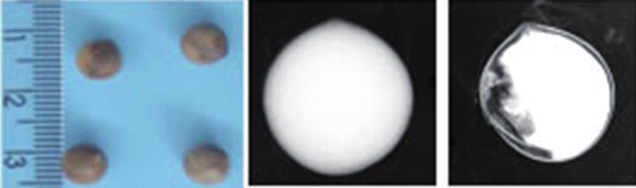 radiografia de semente com pequeno dano na região do eixo embrionário (C) A