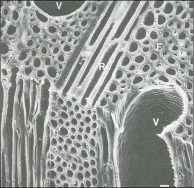 Cell distribution in the xylem of angiosperm wood (X) corte transversal, (R) corte radial e (T) corte tangencial.