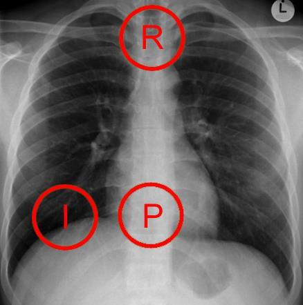 Radiografia do Tórax Qualidade Técnica