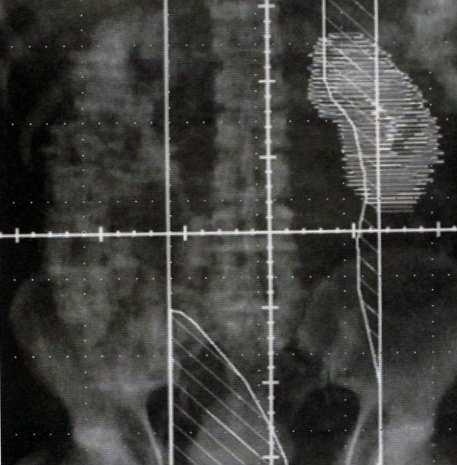 Yang, et al Características Retrospectivo 43 pacientes de 1995 e 2008, com