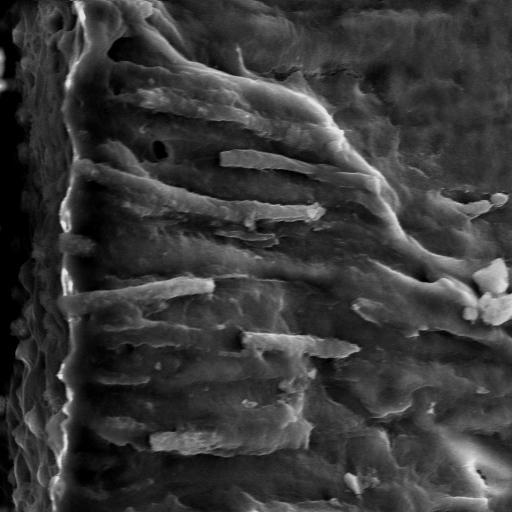 104 FIGURA 29 Fotomicrografia grupo 3B (clorexidina + EDTA), mostrando superfície dentinária com penetração