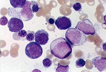 nucleadas são eritroblastos.