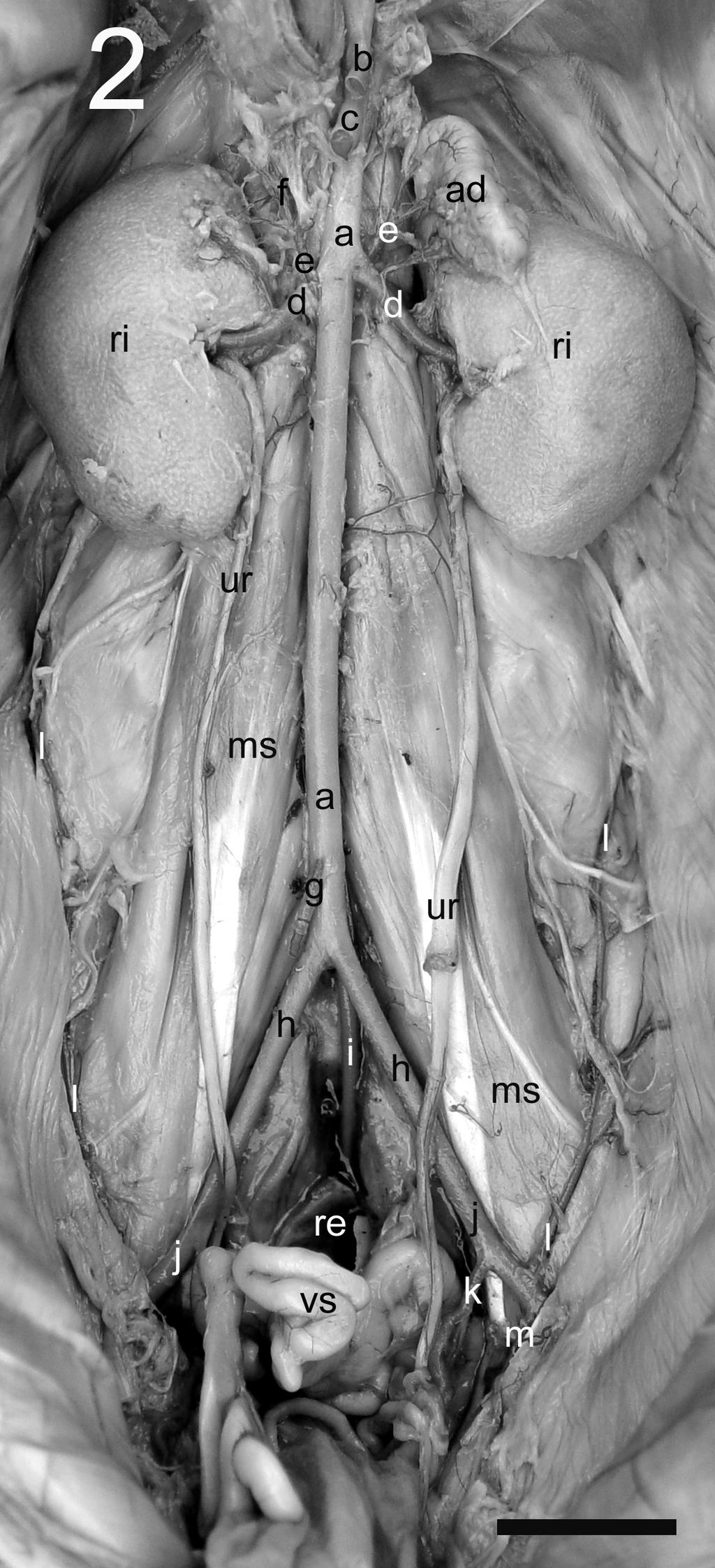 1000 Culau et al. continuando-se como artéria testicular que saiu pelo anel inguinal, incorporada ao funículo espermático até atingir o testículo.