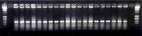 33 211 pb Figura VIII - Amostras representativas dos produtos de PCR nested da ORF 26 do genoma do HHV-8 (banda de 211 pb), quando