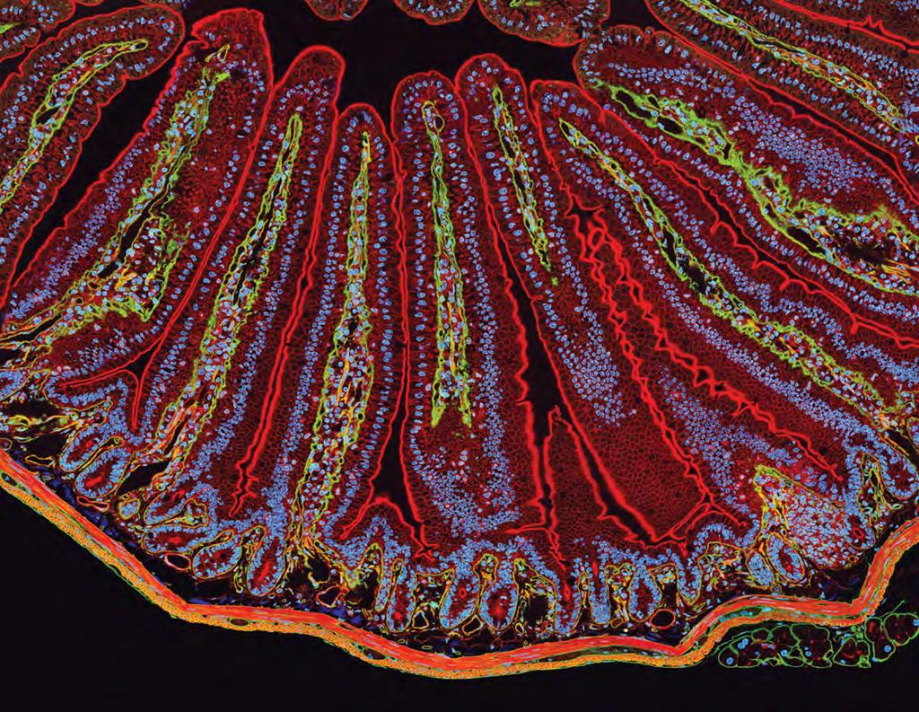 Microfilamentos e