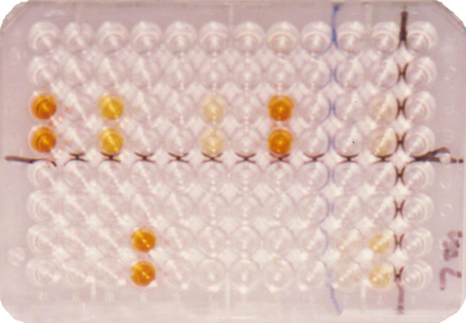 Elisa de Competição: Detecção de anticorpos contra