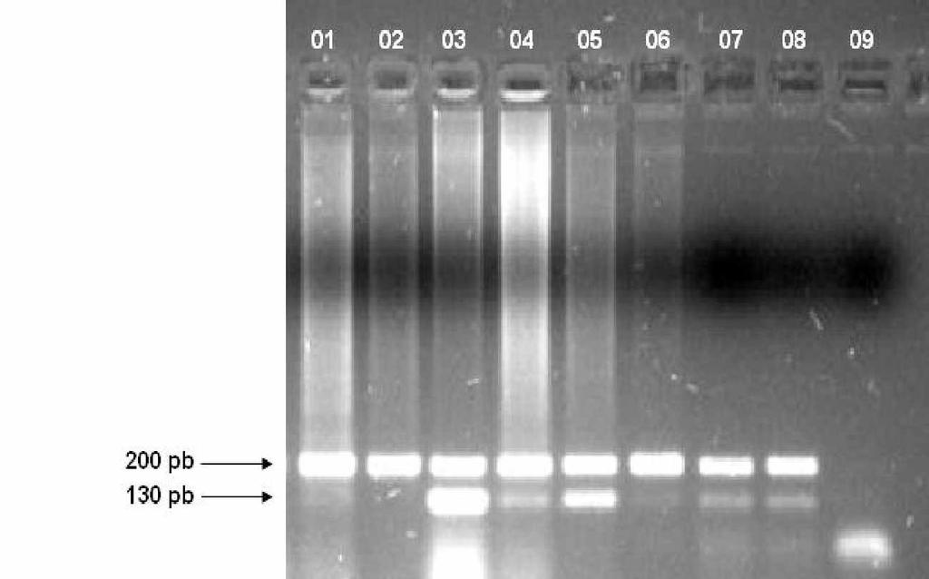 Gráfico 5: Porcentagens de positividade à PCR para detecção do DNA de M. leprae em swab nasal de pacientes com hanseníase de acordo com a classificação clínica.