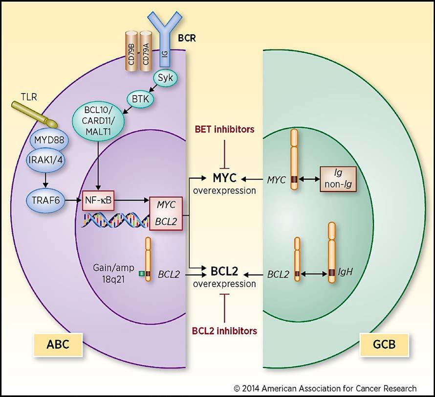 mecanismos levando a hiperexpressão de MYC e BCL2 DEL DHL DEL ABC: 70% DHL