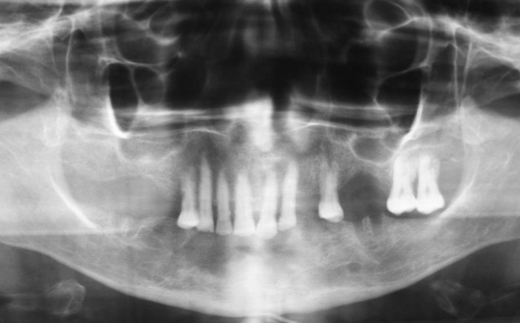 conjuntiva da lesão cística (H.E 400x). Fig.