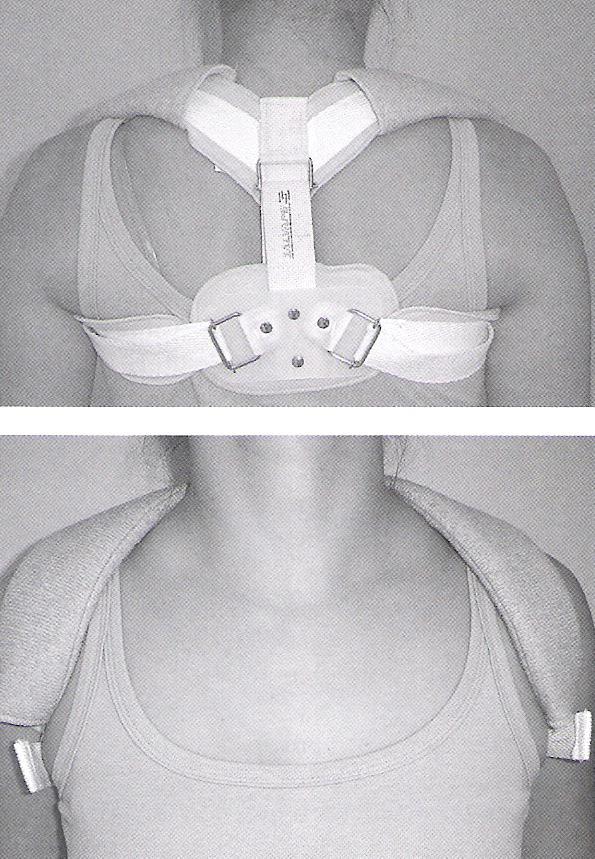 Tirante clavicular ou