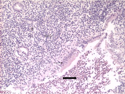 109 Útero bovino; no lúmen (L) há presença de exsudato neutrofílico (seta cheia); no epitélio, de padrão colunar, há migração intra-epitelial de neutrófilos e linfócitos (flecha); no estroma