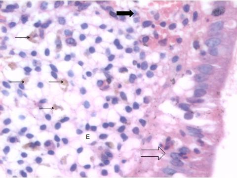 Figura 9 - Observação de detalhe histológico de útero bovino Útero bovino; no epitélio, de padrão colunar, há migração intra-epitelial de