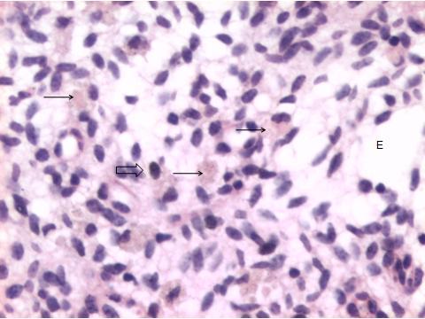 111 Útero bovino; no estroma há presença de edema (E), macrófagos com pigmento, hemossiderina (flechas) e infiltrado de