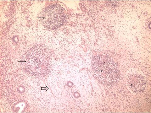 Figura 11 - Observação de detalhe histológico de útero bovino Útero bovino; no estroma há infiltrado de células inflamatórias