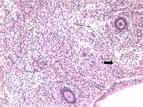 113 Útero bovino; no epitélio, de padrão colunar, há migração intra-epitelial de linfócitos (seta vazia); no estroma, com presença de infiltrado de células inflamatórias de intensidade discreta, há