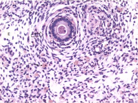 Figura 15 - Observação de detalhe histológico de útero bovino Útero bovino; no estroma com presença de infiltrado de células inflamatórias de intensidade discreta, há presença de edema (E),