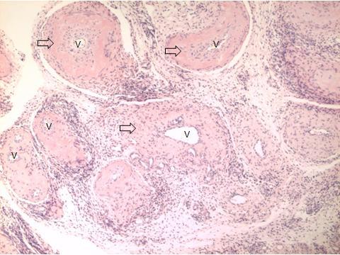 Figura 17 - Observação de detalhe histológico de útero bovino Útero bovino; no estroma, há presença de alteração vascular,