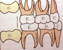 Material e métodos 63 Plano Terminal Reto (PTR): As superfícies distais dos segundos molares