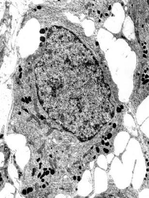 Cromófobas: células endócrinas