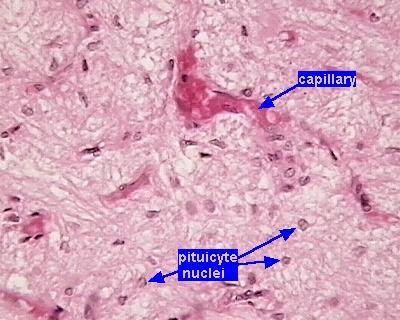 Pars nervosa capilar corpo de Herring núcleos de pituícitos núcleos de pituícitos