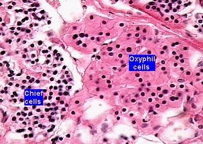 Células Oxífilas: Função desconhecida e raramente formam tumores São ausentes até 5 a 7 anos de idade e seu número aumenta com a idade Também aumentam em pacientes com doença renal crônica e em