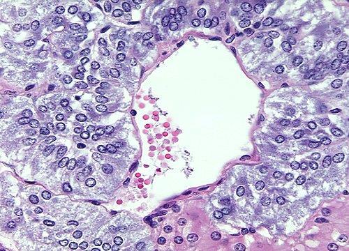 Adrenal Medula Células Cromafins Células