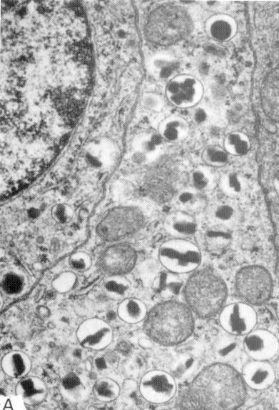 Células Secretam Glucagon