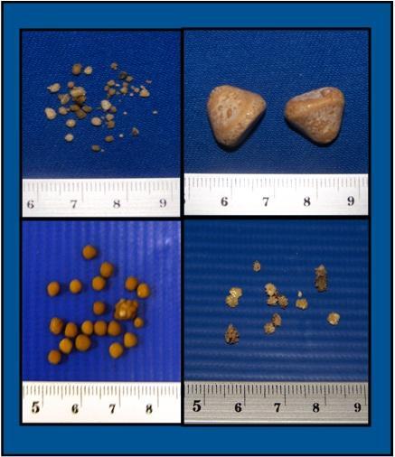 36 mais encontrado (OYAFUSO, 2008; OSBORNE, et al., 1999a; LULICH, et al. 1999a; LULICH, et al. 1999b; OSBORNE et al., 1999c; OSBORNE et al., 2009b; CAMARGO, 2004). Segundo Osborne et al.