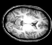 MRI: Anatomia Imageamento