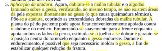 Questão 30: A alternativa apresentada no gabarito é a única correta, conforme segue: McRae Trauma Ortopédico: Gerenciando