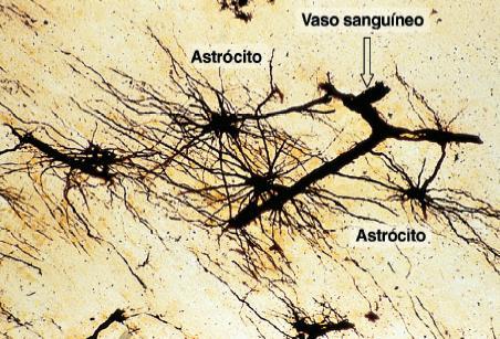 ASTRÓCITOS PROTOPLASMÁTICOS: