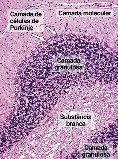 MEDULA