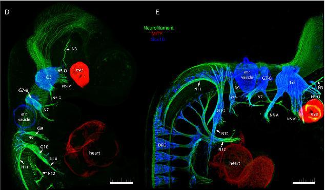 lateral da cabeça) Arco Nervo 1 V= Trigeminal 2