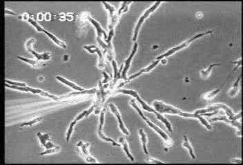 Motivation - General 2 Dictyostelium Discoideum under starvation form clusters following camp gradients. D. discoideum amoebae towards a point source of the chemoattractant camp. From G.