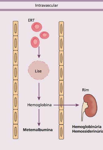 Introdução Hemoglobinúria pós-parto: quebra de hemácias Osmose H2O -