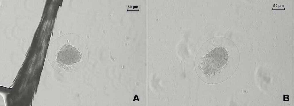 Obtenção dos Estágios Esporogônicos Infecção experimental do exemplar Cdt05 - Em mosquitos A.