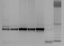 Caracterização molecular pela técnica de PCR Como a tentativa de utilização dos oligonucleotídeos internos HepF e HepR para amplificação do DNA das amostras Cdt05, Cdt07, Cdt01 e Cdt09, não foi bem