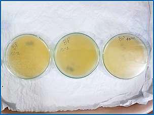 Ausência de Staphylococcus aureus no Plate Count Agar. Figura 24.