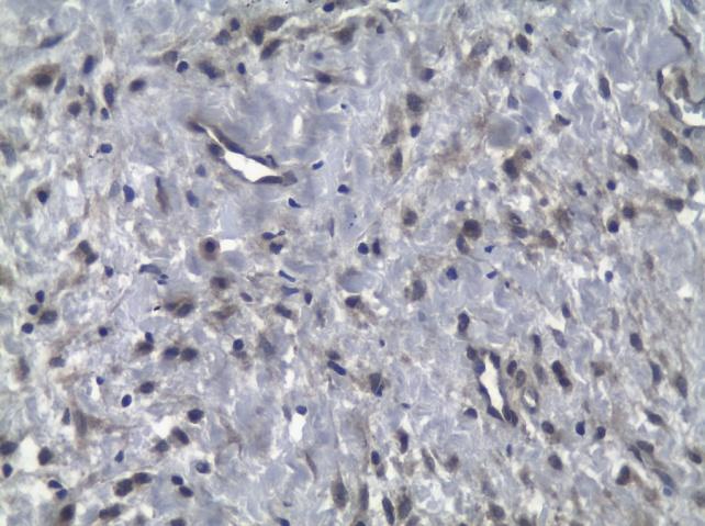 Expressão de TGF beta 1 em fibroblastos, células