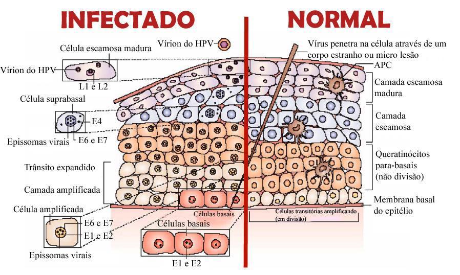 No decorrer da diferenciação terminal celular, o ciclo de vida do HPV se completa com a codificação das proteínas estruturais L1 e L2 dentro do núcleo da célula hospedeira.