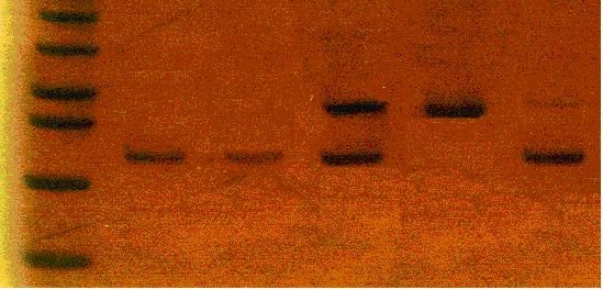61 500p b 400p b 300p b 200p b 1 2 3 4 5 6 Figura 5 - Eletroforese, em gel de poliacrilamida a 8% corado pela prata, dos produtos de PCR-RFLP do fragmento de