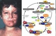 Xeroderma pigmentosum envelhecimento precoce